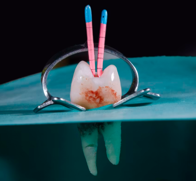 Endodonzia